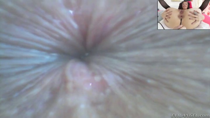 Cattail reccomend anal endoscope rectum camera inside