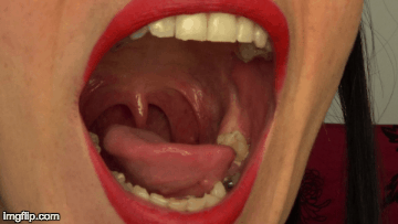 Open throat show long uvula