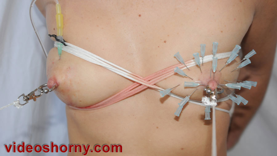 best of Electro needle with catheter testicles