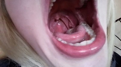 Roar recomended long uvula open throat show